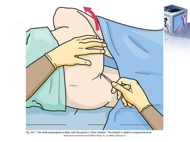 Rectal Temperature with Electronic Thermometer